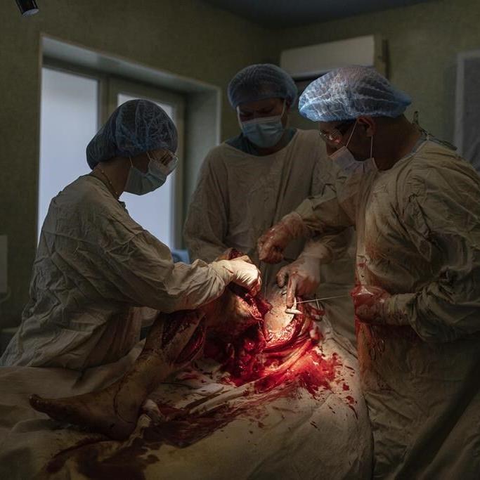 On their own front line, Ukrainian surgeons treat waves of soldiers since the counteroffensive began